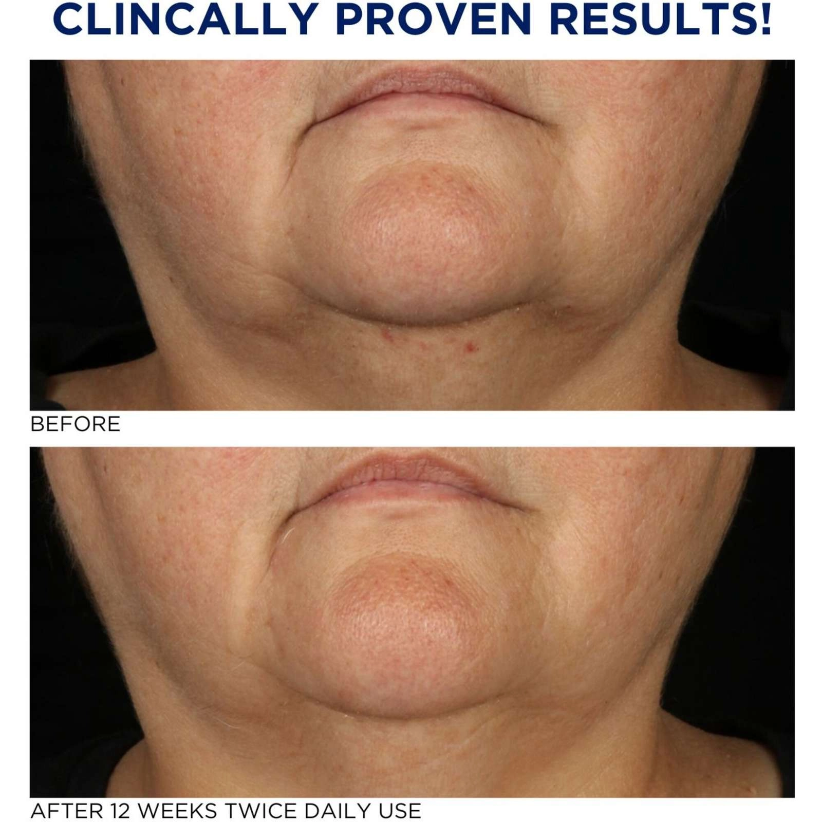 Neostrata Tri-Therapy Lifting Serum with MicroDiPeptide229 for Fine Lines, Wrinkles, and Age Spots - Image 4
