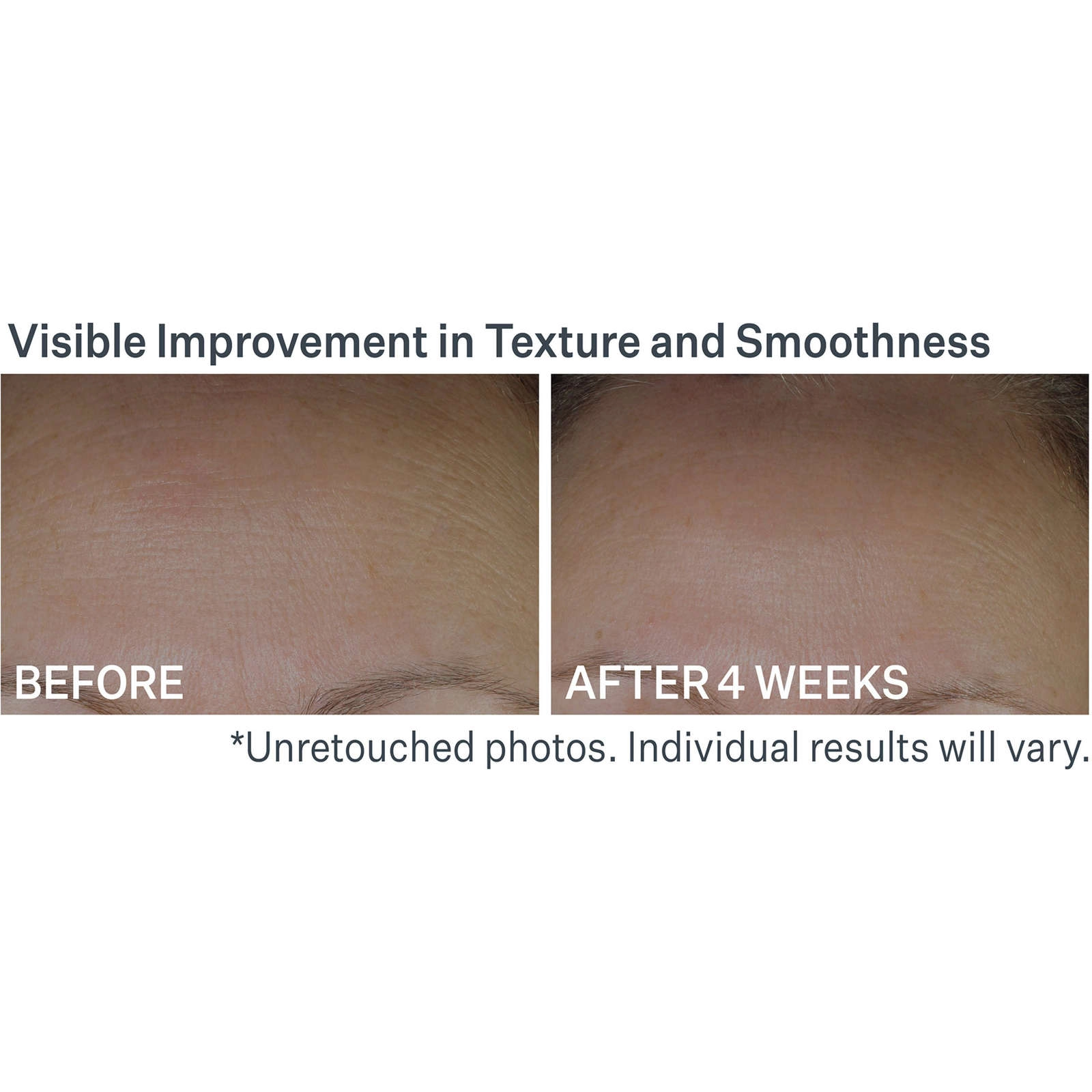 StriVectin Anti-Wrinkle Peptide Plump™ Serum for Smooth, Plump Skin - 1 oz - Image 4